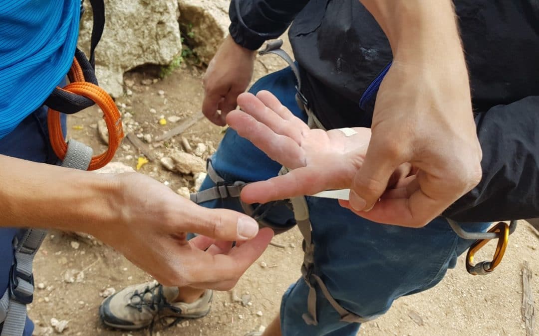 Le lesioni della puleggia nei climbers – Utilizzo del Tape