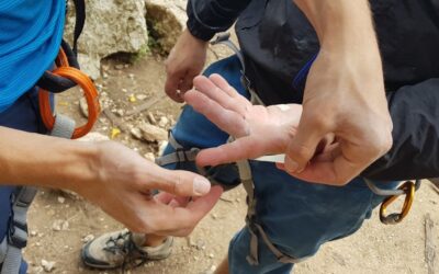 Le lesioni della puleggia nei climbers – Utilizzo del Tape