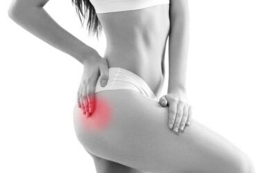 La tendinite del Medio Gluteo